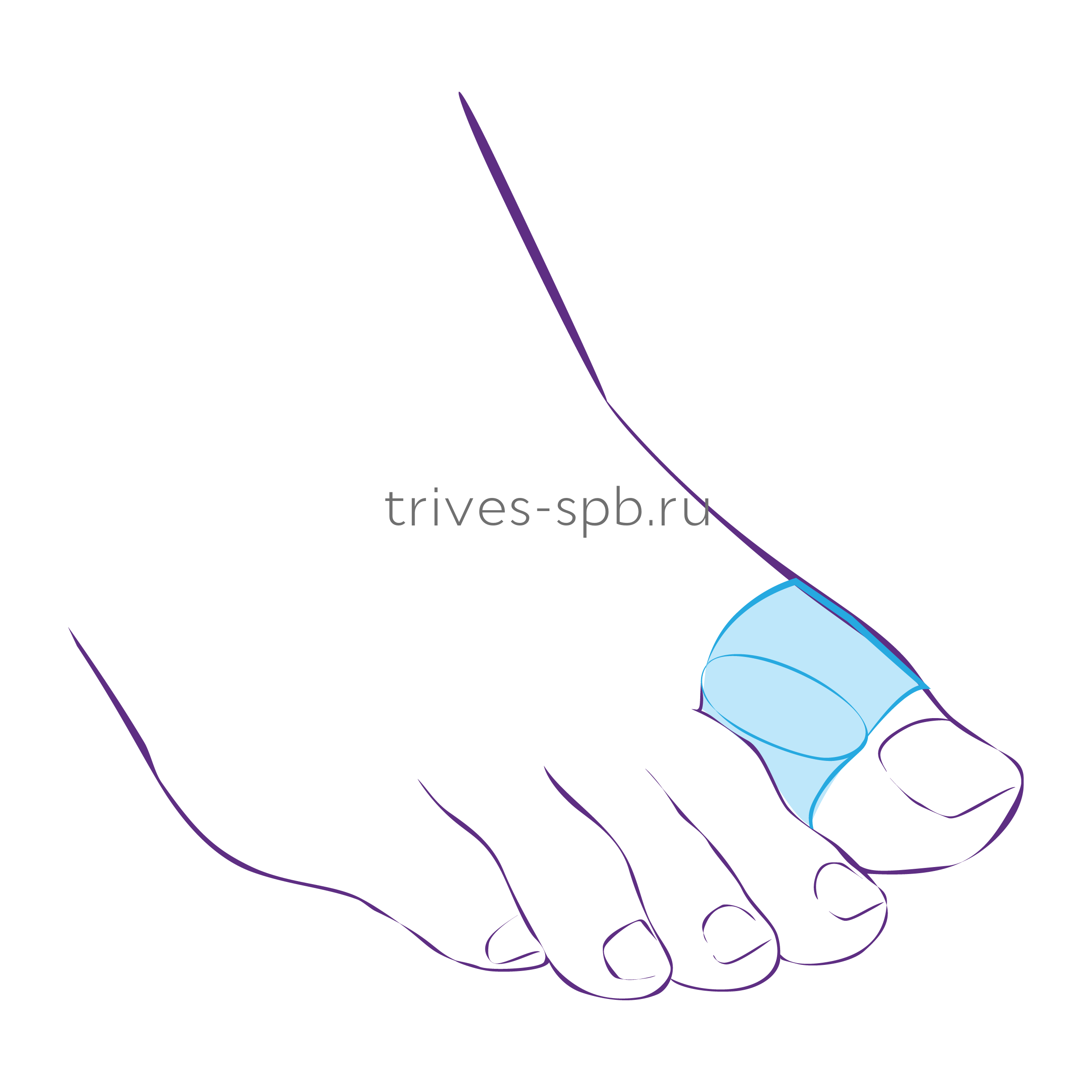 фото Межпальцевая перегородка с кольцом на первый палец стопы СТ-54 от АО Липецкмедтехника